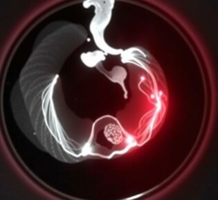 CT Scans for Appendicitis: Understanding the Role of Advanced Imaging in Diagnosis