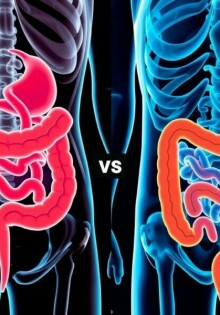 Appendizitis vs. Morbus Crohn oder Colitis ulcerosa: cómo distinguir una urgencia aguda de una enfermedad inflamatoria crónica