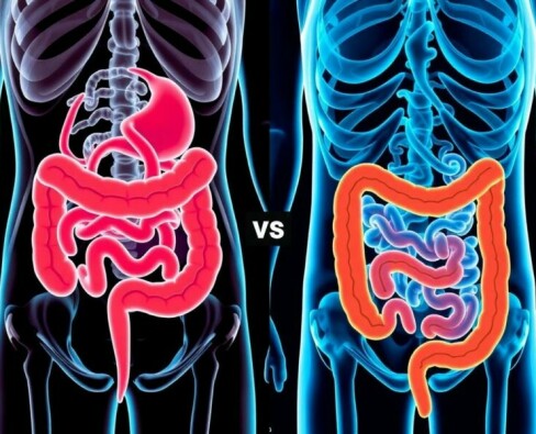 Appendizitis vs. Morbus Crohn oder Colitis ulcerosa: cómo distinguir una urgencia aguda de una enfermedad inflamatoria crónica