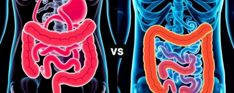 Appendizitis vs. Morbus Crohn oder Colitis ulcerosa: cómo distinguir una urgencia aguda de una enfermedad inflamatoria crónica