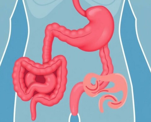 Cuando el apéndice habla: L’appendicite et la maladie de Crohn — entender dos procesos que a veces se confunden