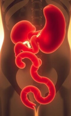 Thromboseprophylaxe nach Blinddarm-OP: So schützen Sie sich effektiv vor gefährlichen Komplikationen