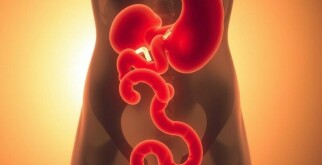 Thromboseprophylaxe nach Blinddarm-OP: So schützen Sie sich effektiv vor gefährlichen Komplikationen