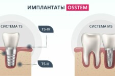 Вьюрок канареечный: очарование и загадки маленького певца