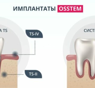 Вьюрок канареечный: очарование и загадки маленького певца