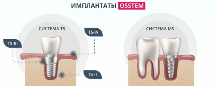 Вьюрок канареечный: очарование и загадки маленького певца