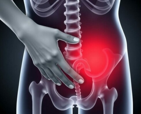 ¿La apendicitis siempre duele del lado derecho? Desmontando mitos, entendiendo señales y qué hacer