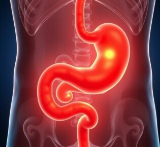 Antibiotikatherapie bei unkomplizierter Appendizitis: Eine moderne Alternative zur Operation