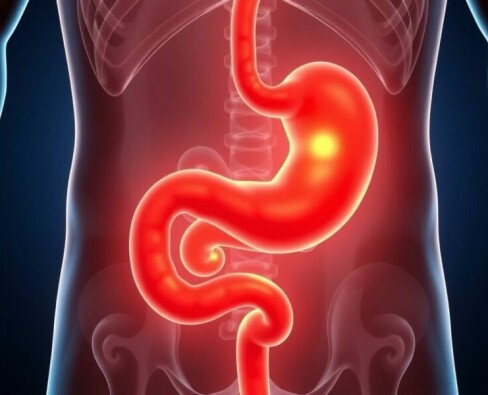 Antibiotikatherapie bei unkomplizierter Appendizitis: Eine moderne Alternative zur Operation