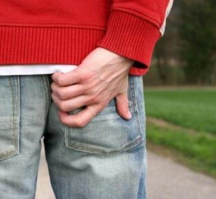 Как устранить зуд при геморрое