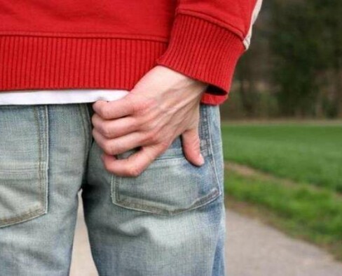 Как устранить зуд при геморрое