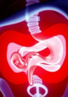 Apendicitis en niños: síntomas atípicos que no debes ignorar