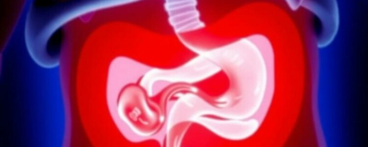 Apendicitis en niños: síntomas atípicos que no debes ignorar