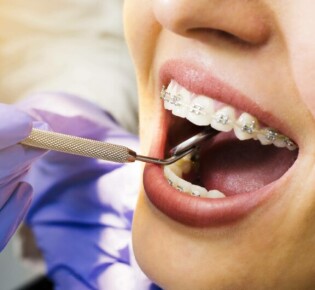 Особенности ортодонтии в стоматологии