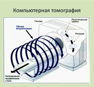 Что значит холецистит и как с ним справиться?