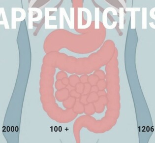 La apendicitis en los libros de medicina a través de las décadas: una historia que late entre páginas, dibujos y bisturíes
