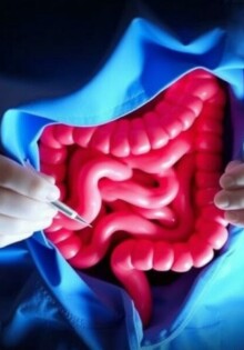 La «Interval Appendectomy»: ¿Por qué a veces la cirugía espera y la medicina actúa primero?