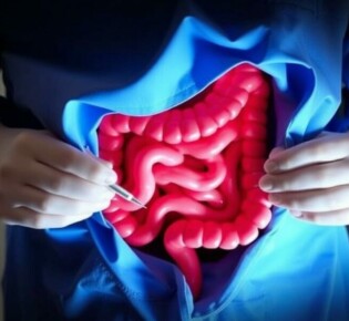 La «Interval Appendectomy»: ¿Por qué a veces la cirugía espera y la medicina actúa primero?