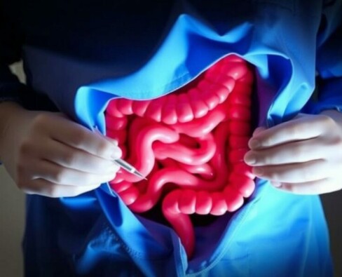 La «Interval Appendectomy»: ¿Por qué a veces la cirugía espera y la medicina actúa primero?
