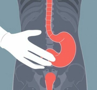 Appendicite et Grossesse : Comprendre les Risques et Précautions Essentielles