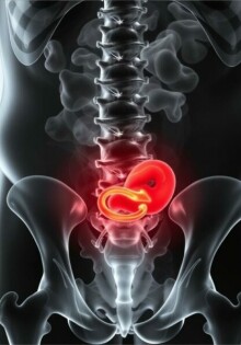 Typische Schmerzlokalisation bei Appendizitis: Ein umfassender Leitfaden