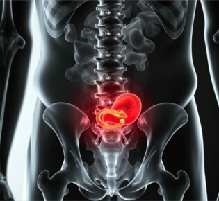 Typische Schmerzlokalisation bei Appendizitis: Ein umfassender Leitfaden