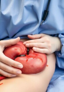 Aufklärung des Patienten vor einer Appendektomie: cómo informar, tranquilizar y empoderar antes de la cirugía