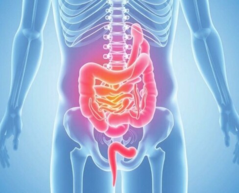 Por qué el dolor de la apendicitis empieza alrededor del ombligo y luego se desplaza al cuadrante inferior derecho