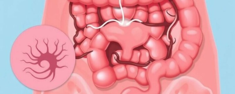 Diferencial diagnóstico: condiciones que imitan una apendicitis (por ejemplo, quistes ováricos, gastroenteritis)