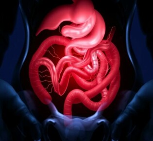 Blinddarmentzündung nach Kaiserschnitt: Ursachen, Symptome und Behandlungsmöglichkeiten