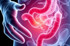Stem Cell Therapy for Appendicitis: A Revolutionary Approach to Healing