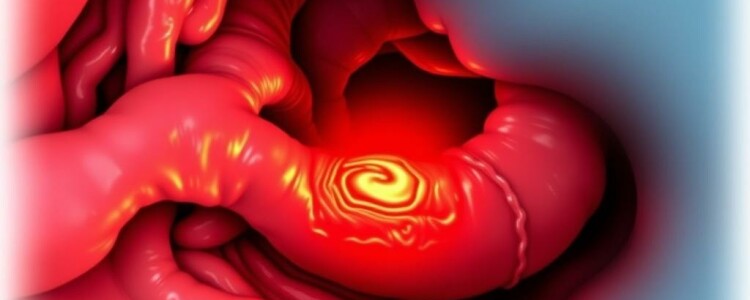 Understanding Appendiceal Abscess: Causes, Symptoms, and Treatment Explained