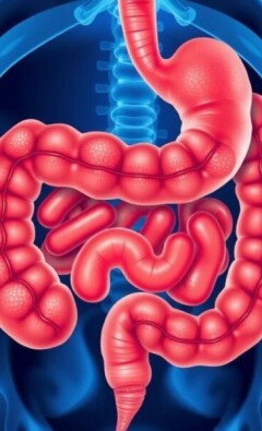 Absceso apendicular: cómo se forma, cómo se diagnostica y cómo se maneja