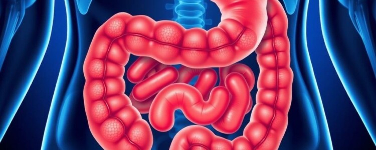 Absceso apendicular: cómo se forma, cómo se diagnostica y cómo se maneja