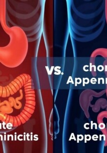 Apendicitis aguda vs. apendicitis crónica: cómo reconocerlas, tratarlas y vivir después