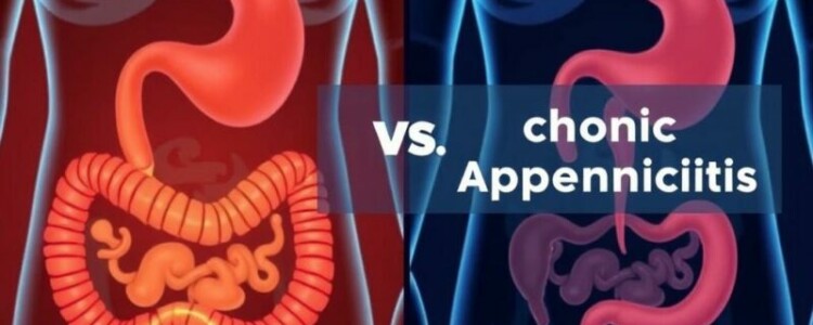 Apendicitis aguda vs. apendicitis crónica: cómo reconocerlas, tratarlas y vivir después