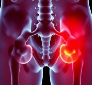 Уретрит: диагностика и терапия – что важно знать каждому