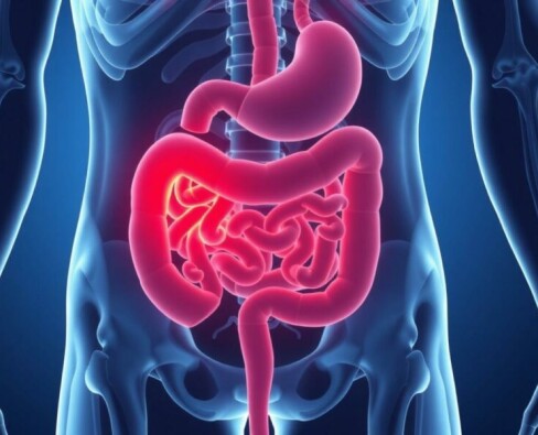 Understanding the Complex Relationship Between Appendicitis and Inflammatory Bowel Disease (IBD)