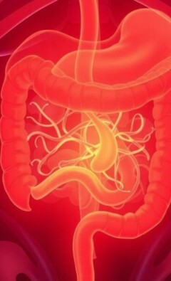 Appendicite et Diarrhée : Quand S’Inquiéter ?