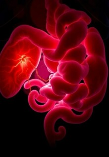 Die Peritonitis (Bauchfellentzündung) como la complicación temida: lo que necesitas saber