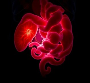 Die Peritonitis (Bauchfellentzündung) como la complicación temida: lo que necesitas saber