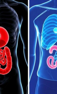 Les Différences Entre Appendicite et Colique Hépatique : Comprendre Pour Mieux Agir