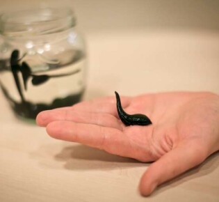 Как лечить геморрой пиявками