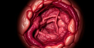 Subphrenischer Abszess: el enemigo silencioso bajo el diafragma