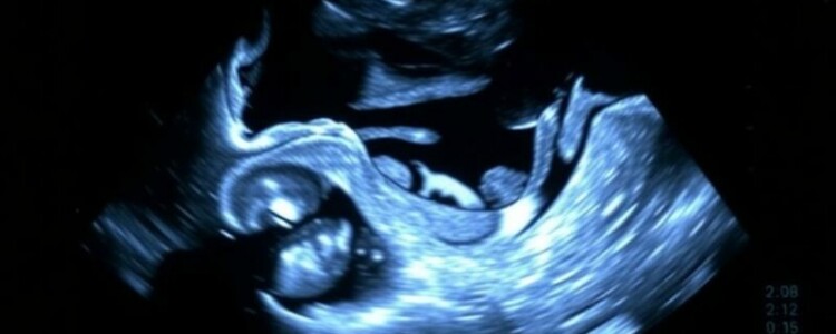 Radiación en niños: ¿Por qué elegir primero el ultrasonido antes que la tomografía computarizada? (Strahlenexposition bei Kindern: Ultraschall vor CT)