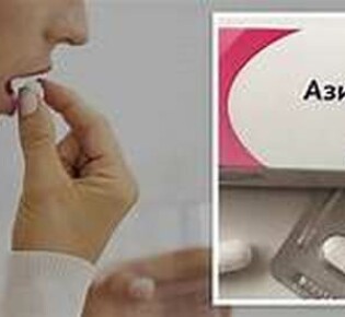 Чечетка: Птичка, Которая Завораживает Своими Песнями