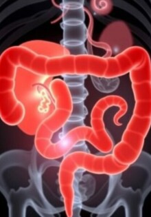 Apendicitis y gastroenteritis: cómo diferenciarlas