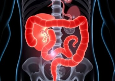 Apendicitis y gastroenteritis: cómo diferenciarlas