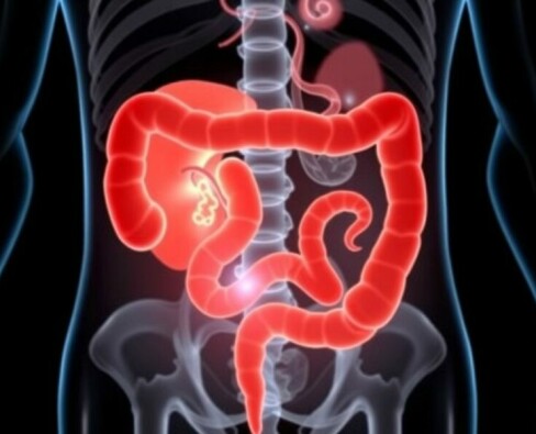 Apendicitis y gastroenteritis: cómo diferenciarlas