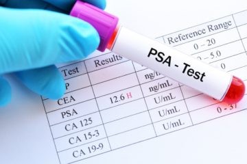 Что такое PSA?
